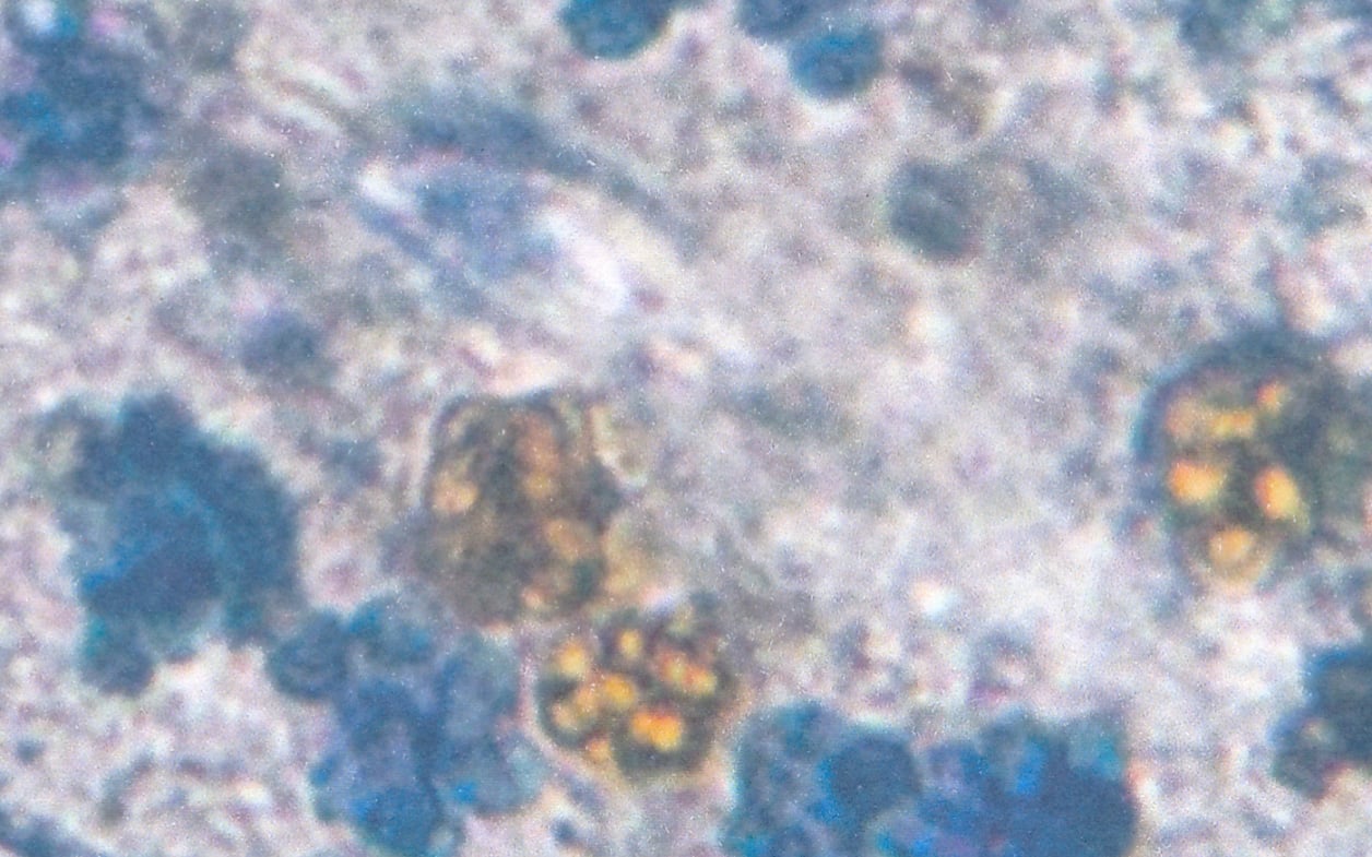 Eine gefahrlose Färbemethode zum Sichtbarmachen der Verdauungsvorgänge beim Pantoffeltierchen im Schulunterricht